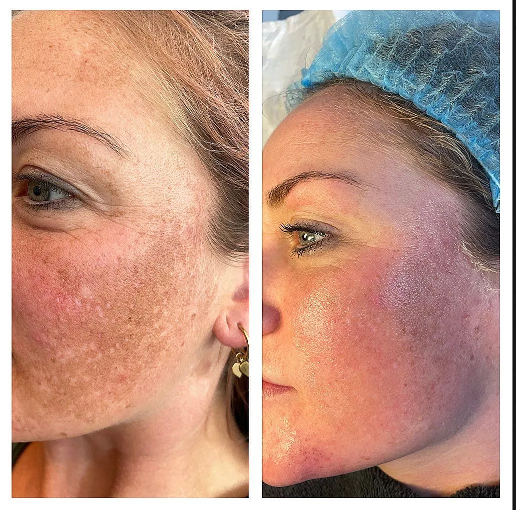 Beautysalon resultaten