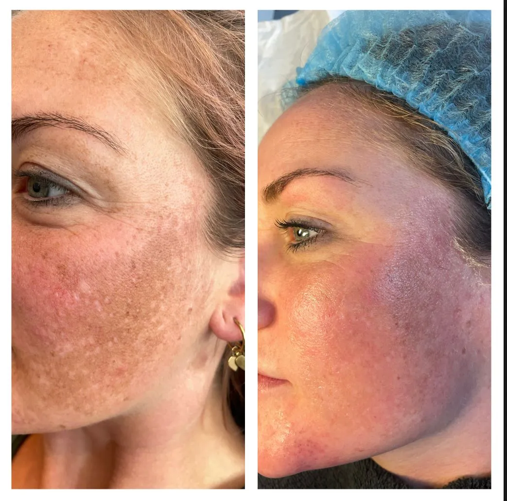 Beauty salon resultaten behandelingen